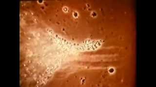 SHAKE THE DISEASE - Love Electrocution