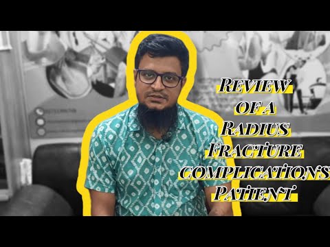 Radius Fracture Complications Patient's Review 