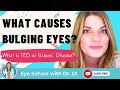 Is Bulging Eye Disease Called Thyroid Eye Disease (TED)?  Is Graves Disease Caused By TED?
