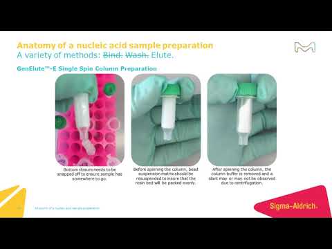 Anatomy of a nucleic acid sample preparation