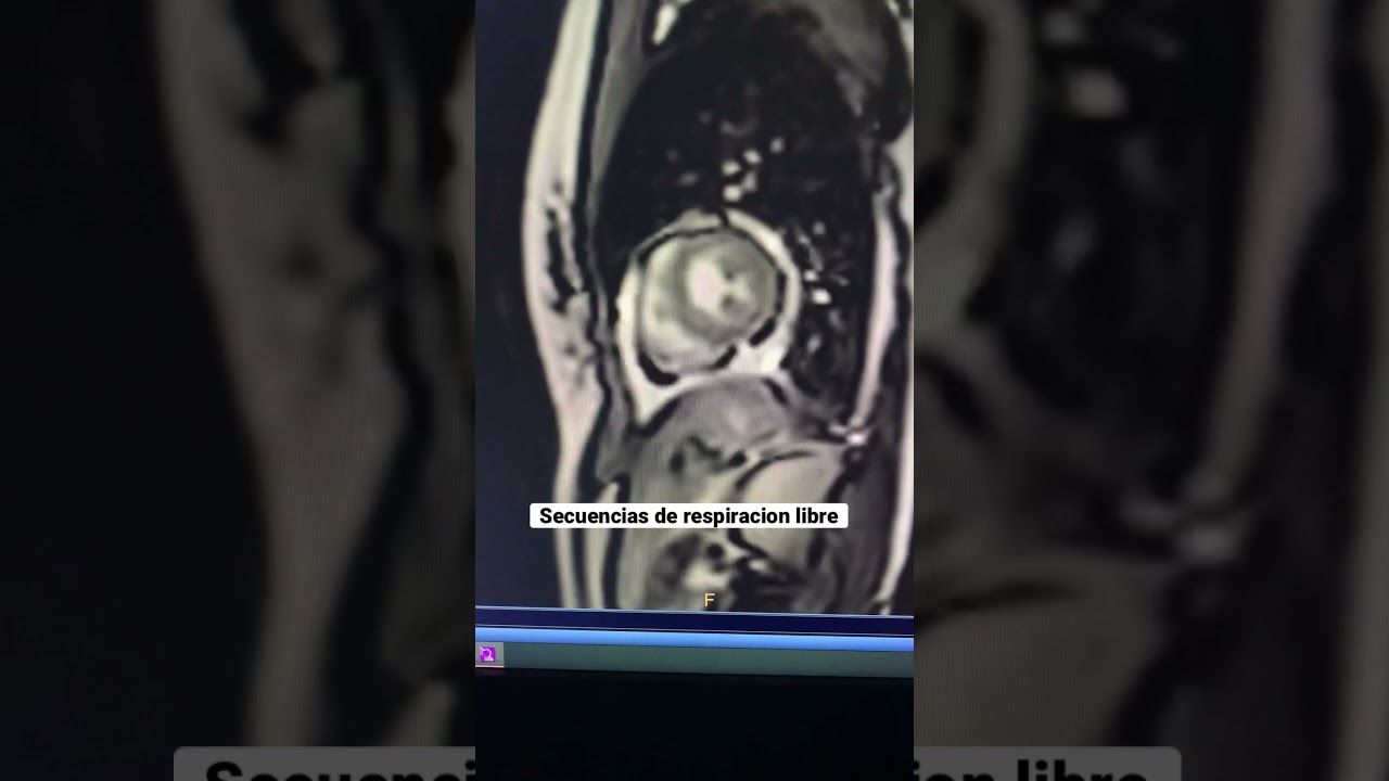 Ayax N. Sobrino Saavedra-14