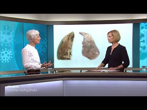 Corona nachgehakt: Langzeitfolgen - welchen Weg nimmt das Virus im Körper?