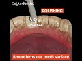 Teeth Cleaning removes stains and yellow color Tartar