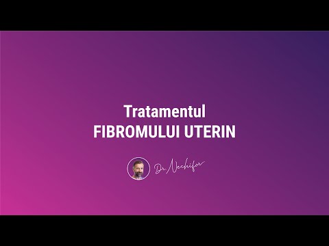 Tratamentul fibromului uterin - Embolizarea Uterina -  Dr. Rares Nechifor