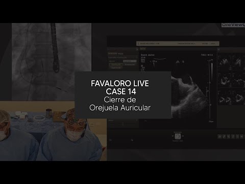 Favaloro Live Case N° 14 - Cierre de Orejuela Auricular