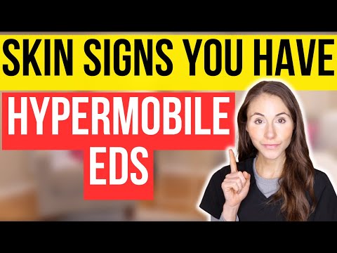 Unlocking The Secrets: 12 Surprising Skin Signs Of Hypermobile Ehlers-Danlos Syndrome
