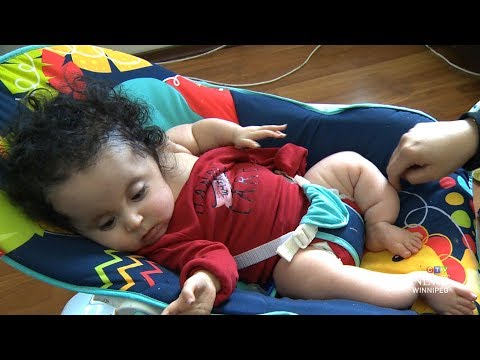 'Glass baby': Tot living with severe bone disease