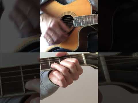 Duele verte - Ricardo Arjona