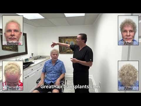  Dr. Brett Bolton patient Patrick MaxHarvest&trade; procedure 

