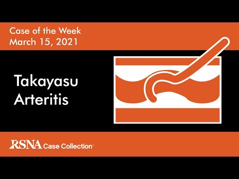 Case of the Week: Takayasu Arteritis