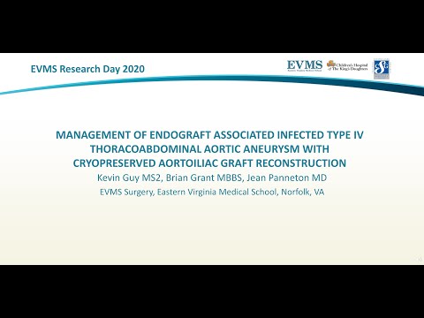 Thumbnail image of video presentation for Management of Endograft associated infected type iv thoracoabdominal aortic aneurysm with cryopreserved aortoiliac graft reconstruction