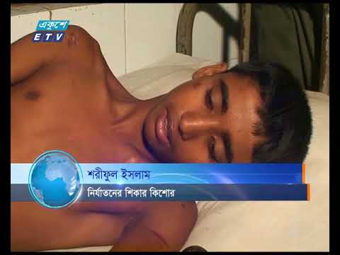 নওগাঁয় চোর সন্দেহে এক কিশোরকে দুইদিন ধরে আটক রেখে অমানবিক নির্যাতন করা হয়েছে