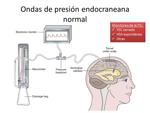 Terapia para la hipertensión Juice Tos remedios para la hipertensión