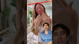 DEEP PHENOL PEEL -And She's Going Out!!!!