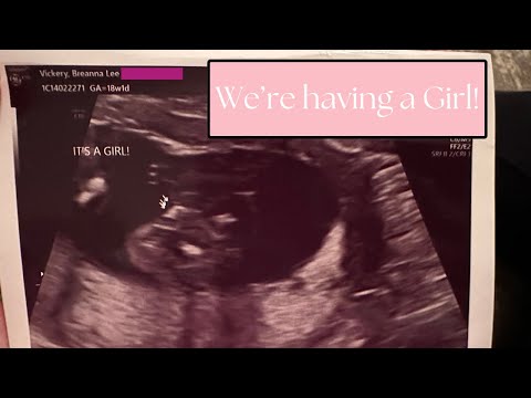 We're having a Girl!