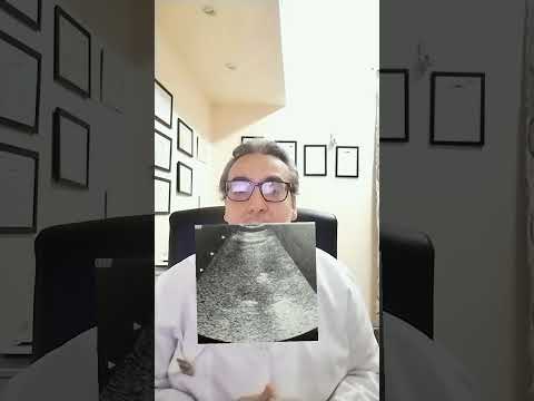 Francesco Inzerra-21