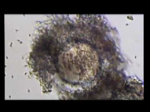 IVF - Microscopic View of Egg-Sperm Date