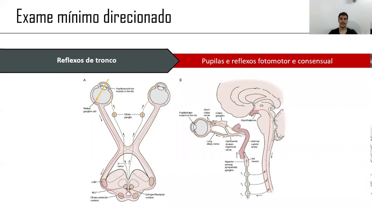 Rebaixamento do nível de consciência