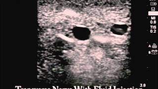 Product video: CAE Blue Phantom Ultrasound Training Blocks