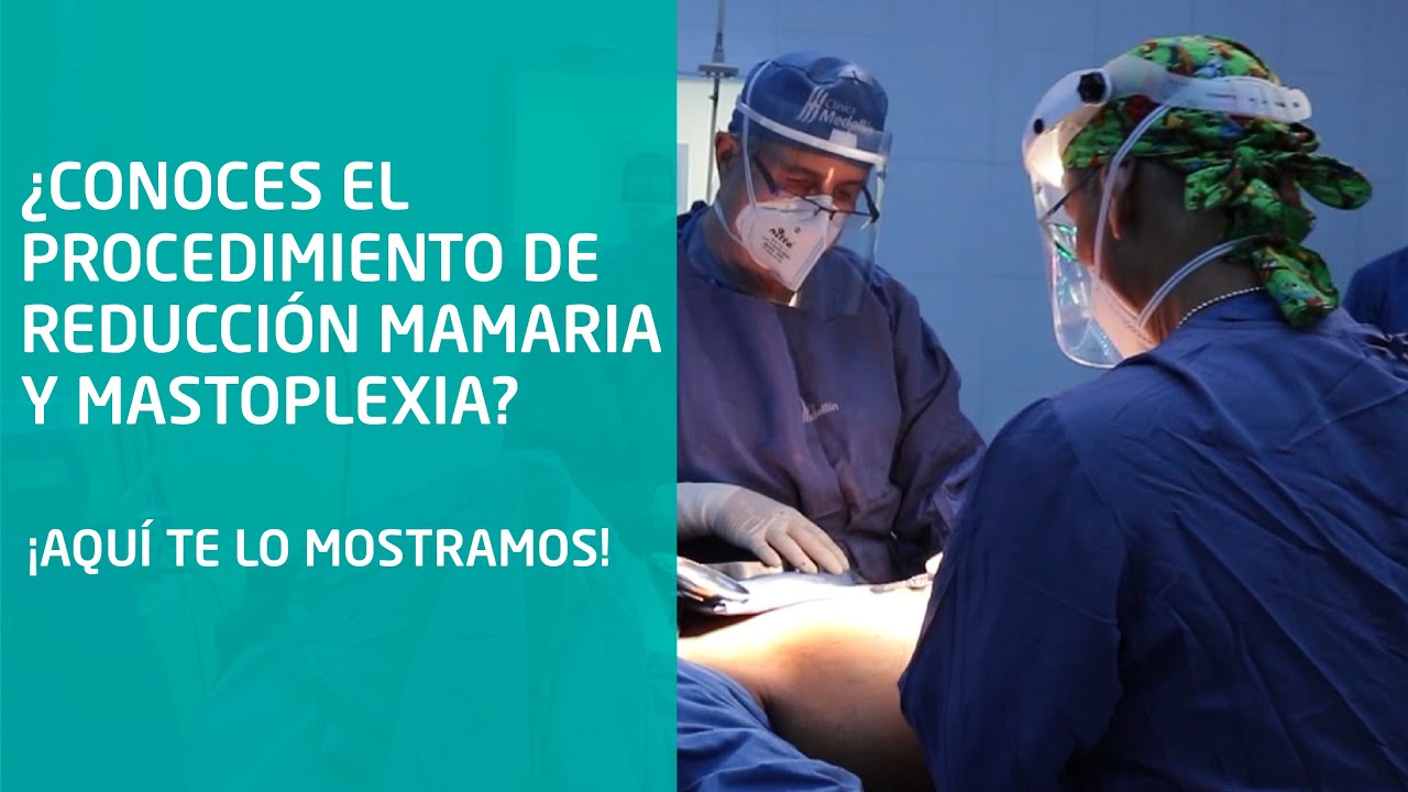 Watch Reducción mamaria y mastopexia Now Reducción mamaria y mastopexia
