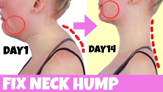 Fix Neck Hump Fat!! Lift Sagging Jowls, Get Slim Long Neck, Look Younger With This Exercises!