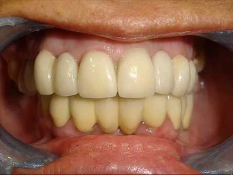 Construcción de Sonrisas