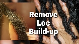 Remove Loc Build-up (NO SOAKING REQUIRED) || Onyx Goddess