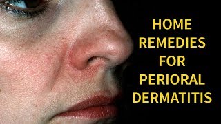 Home Remedies To Get Rid Of perioral dermatitis overnight | Remedies For perioral dermatitis