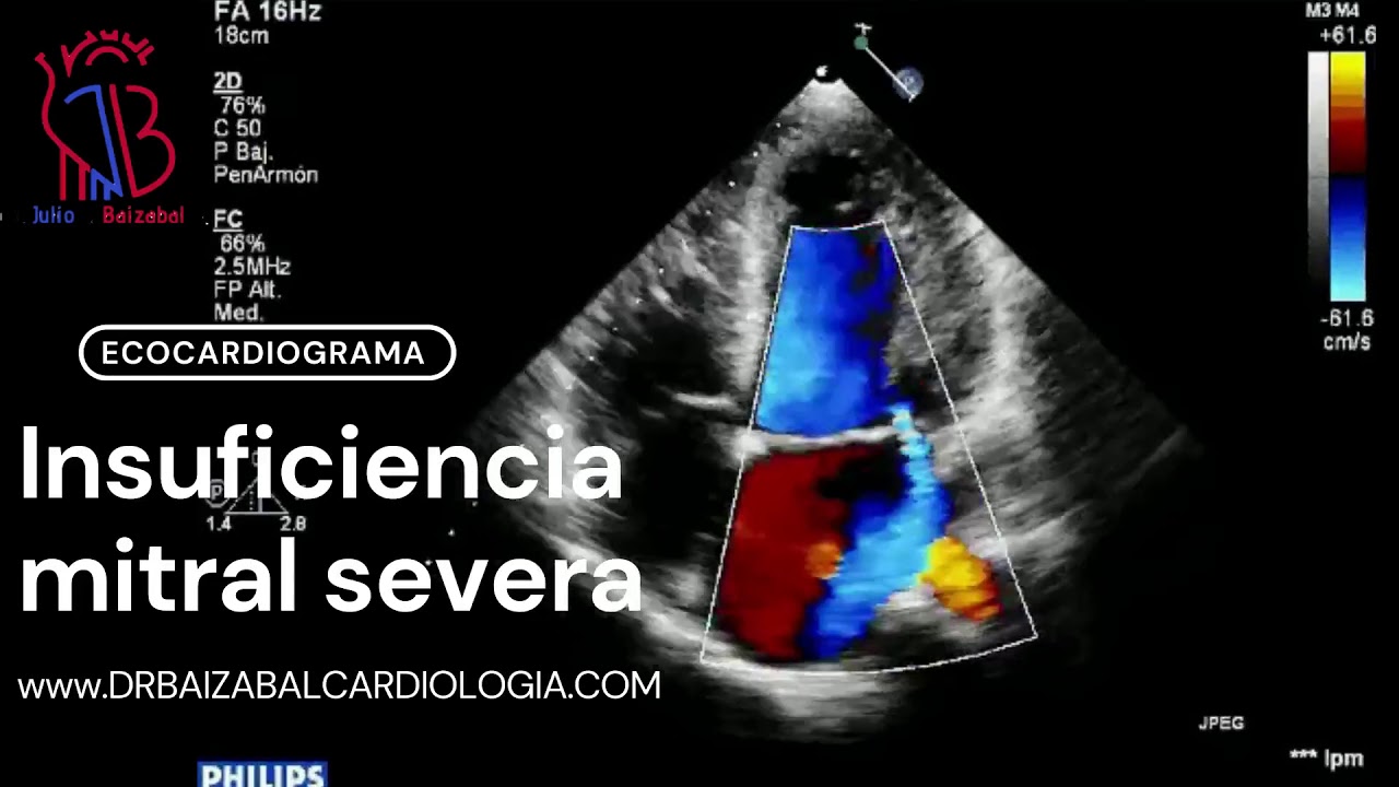 Julio César Baizabal Rebolledo-12