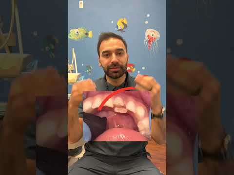 Baby Teeth vs Adult Teeth #shorts