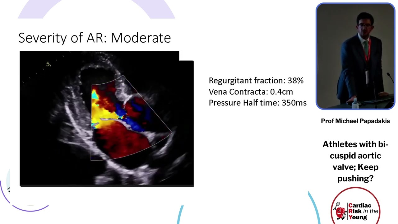 Athletes with bi cuspid aortic valve; Keep pushing - Prof Michael Papadakis