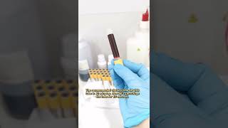 A day in a life of a medical technologist episode 01 | MEDICAL LABORATORY SCIENCE