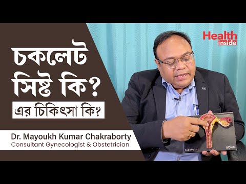 চকলেট সিস্ট কেন হয়? চকলেট সিস্ট এর চিকিৎসা কি? What is chocolate cyst and what are the treatments