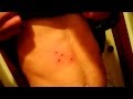 Getting shot with a metal CO2 bb gun 4 times. 