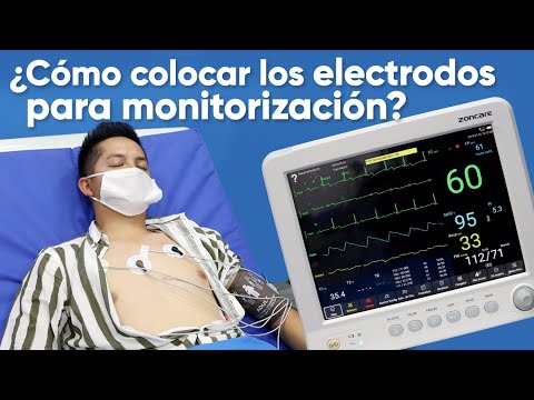 ¿Cómo colocar los electrodos para monitorización?