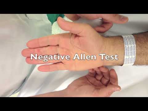 Negative Allen Test