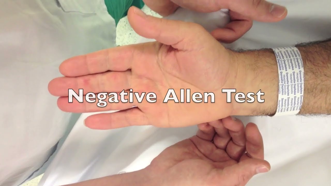 Negative Allen Test