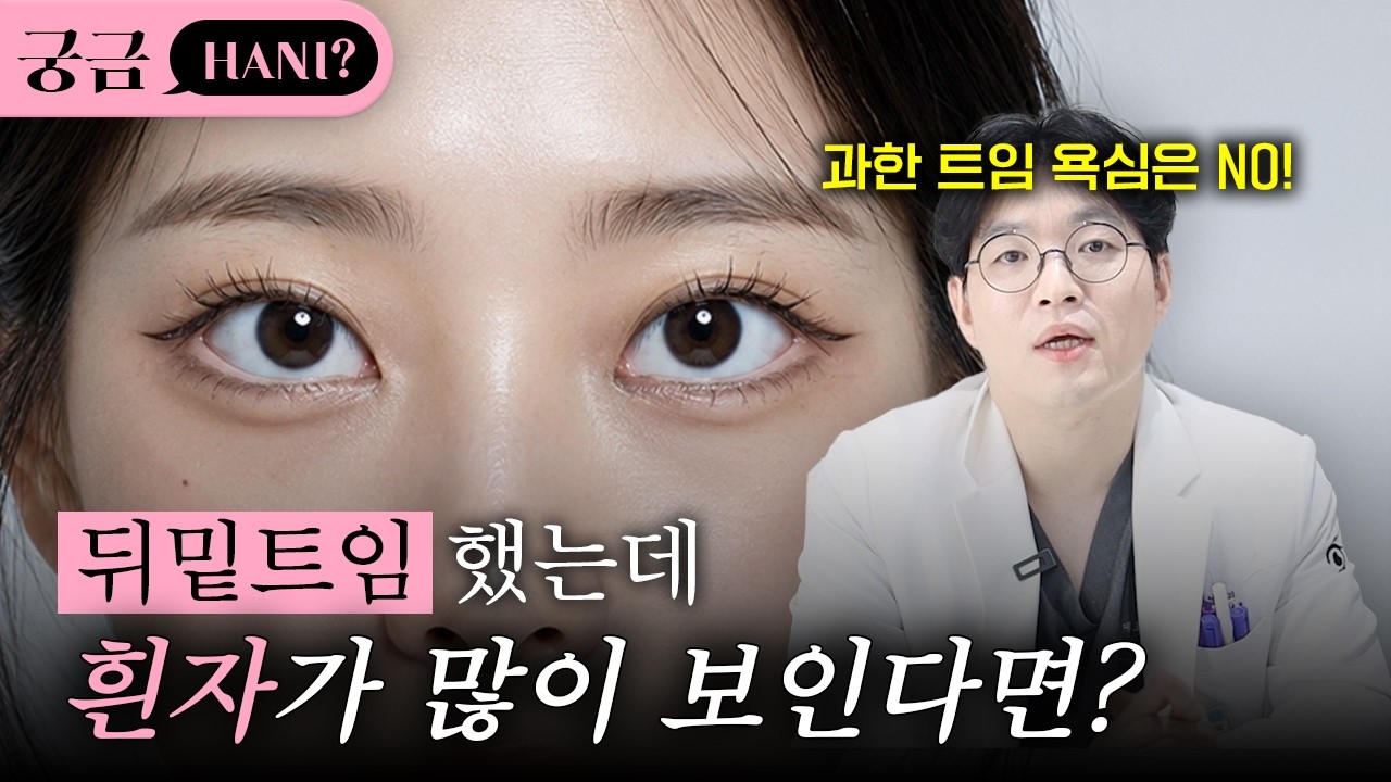 뒤밑트임 했는데 흰자가 많이 보인다면?🤔ㅣ진실이 궁금하니? 쇼츠 영상 미리보기