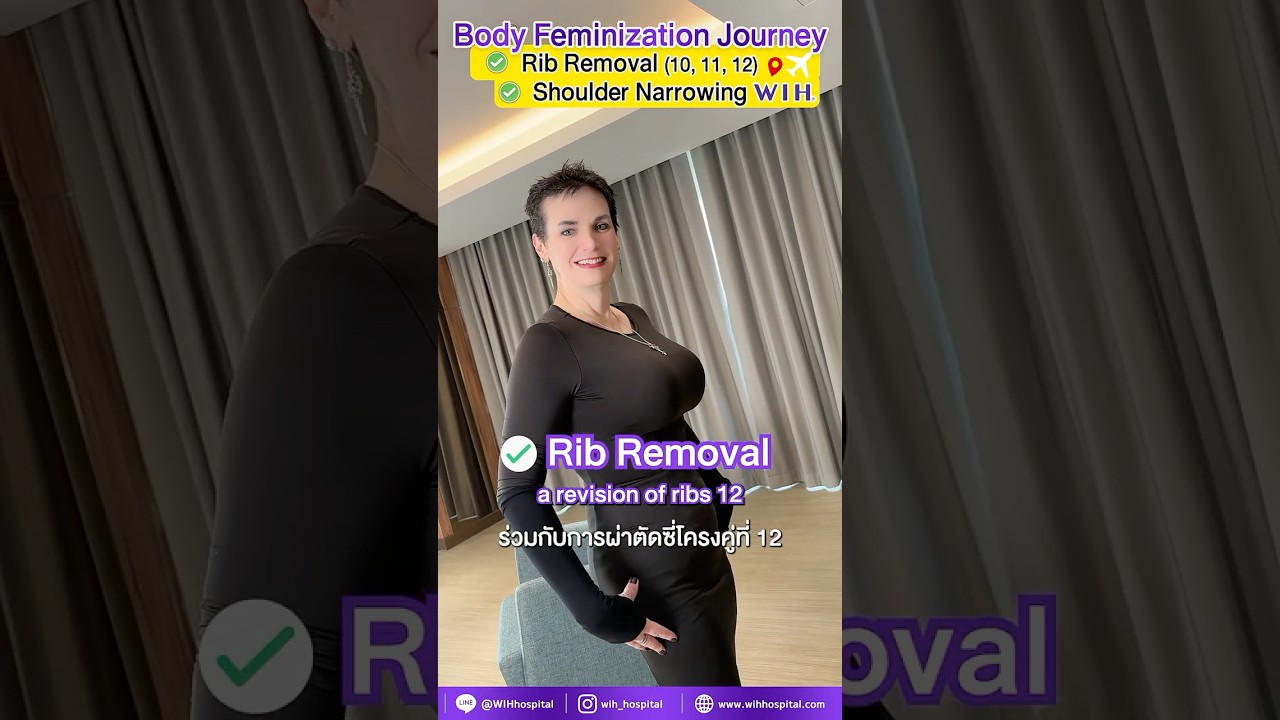 Shoulder Narrowing, Body Feminization Surgery | Vektra, USA