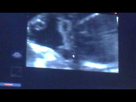 unser baby selma aladin