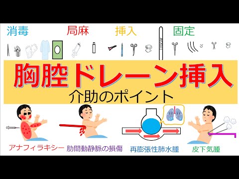 アスピディストラについて詳しく解説