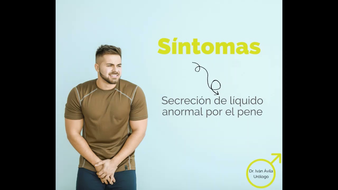 Ivan Antonio Avila Cruz-18