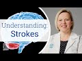 Stroke Causes Risk Factors Treatment And Prevention Mass General Brigham