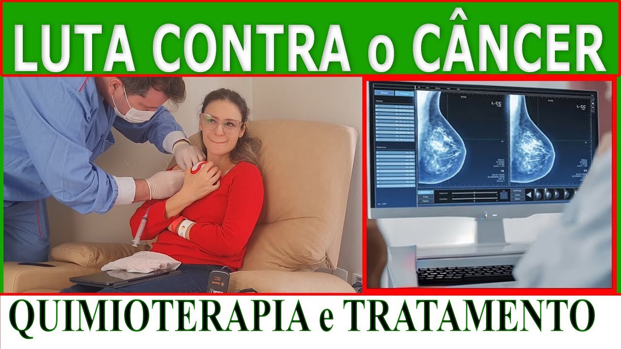 🟢 Quimioterapia Dia 01 | Tratamento contra o Câncer de Mama