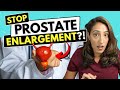 Best Ways To Prevent Prostate Enlargement Explained By A Urologist
