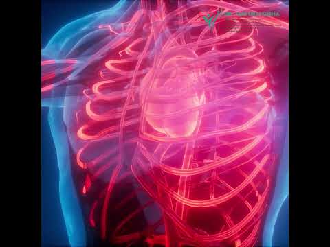 Scoliosis | How early screening can make all the difference