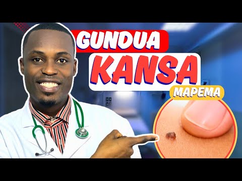 Ukiona Una Dalili Hizi 5 - Kapime Kansa