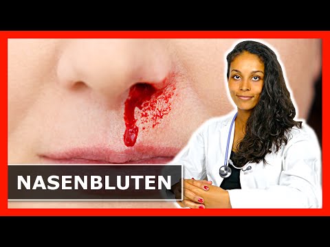 NASENBLUTEN – ERSTE HILFE! Tipps zum Stoppen der Blutung!