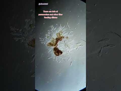 Rubbing Alcohol vs Germs Under Microscope #science #microbiology #microscope