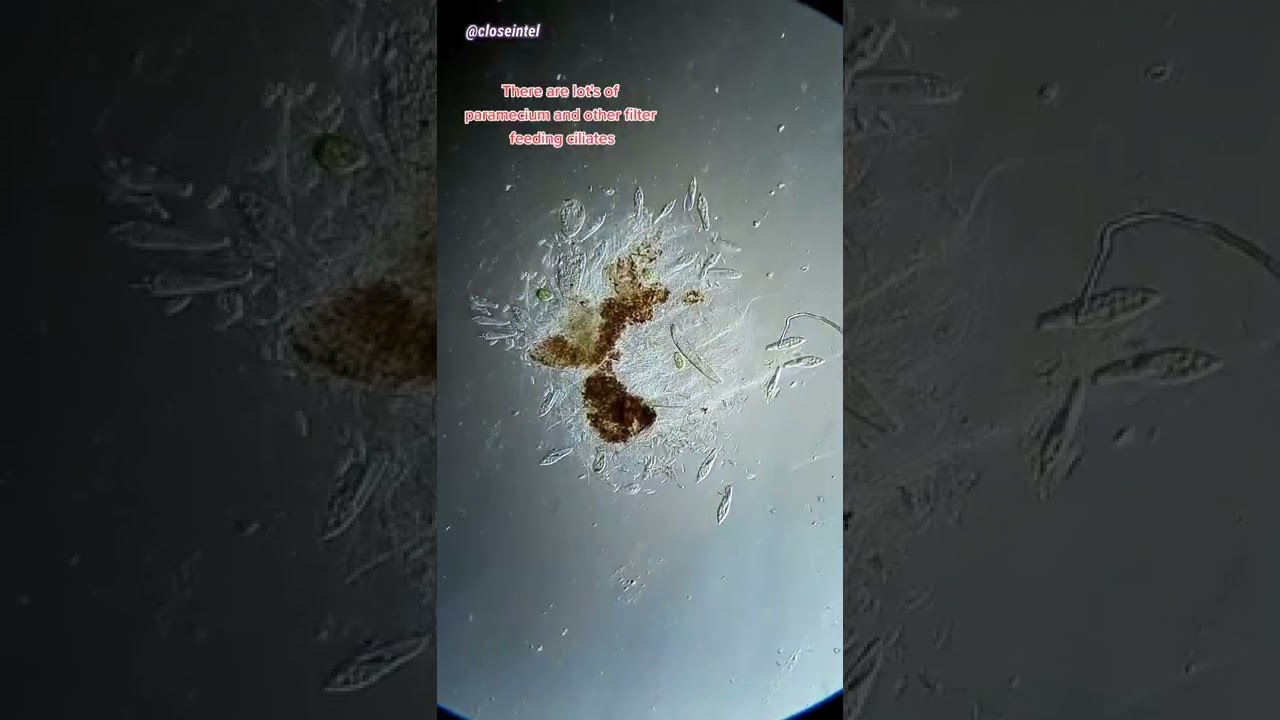 Rubbing Alcohol vs Germs Under Microscope #science #microbiology #microscope